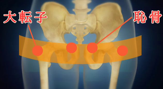 骨盤位置確認写真1